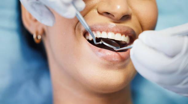 Best Broken or Chipped Tooth Repair in Silt, CO