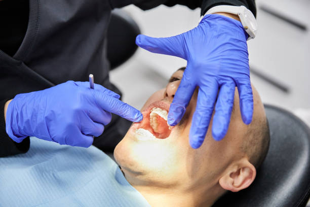Best Broken or Chipped Tooth Repair in Silt, CO